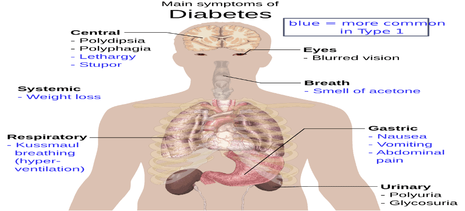Diabetes Research Paper Example